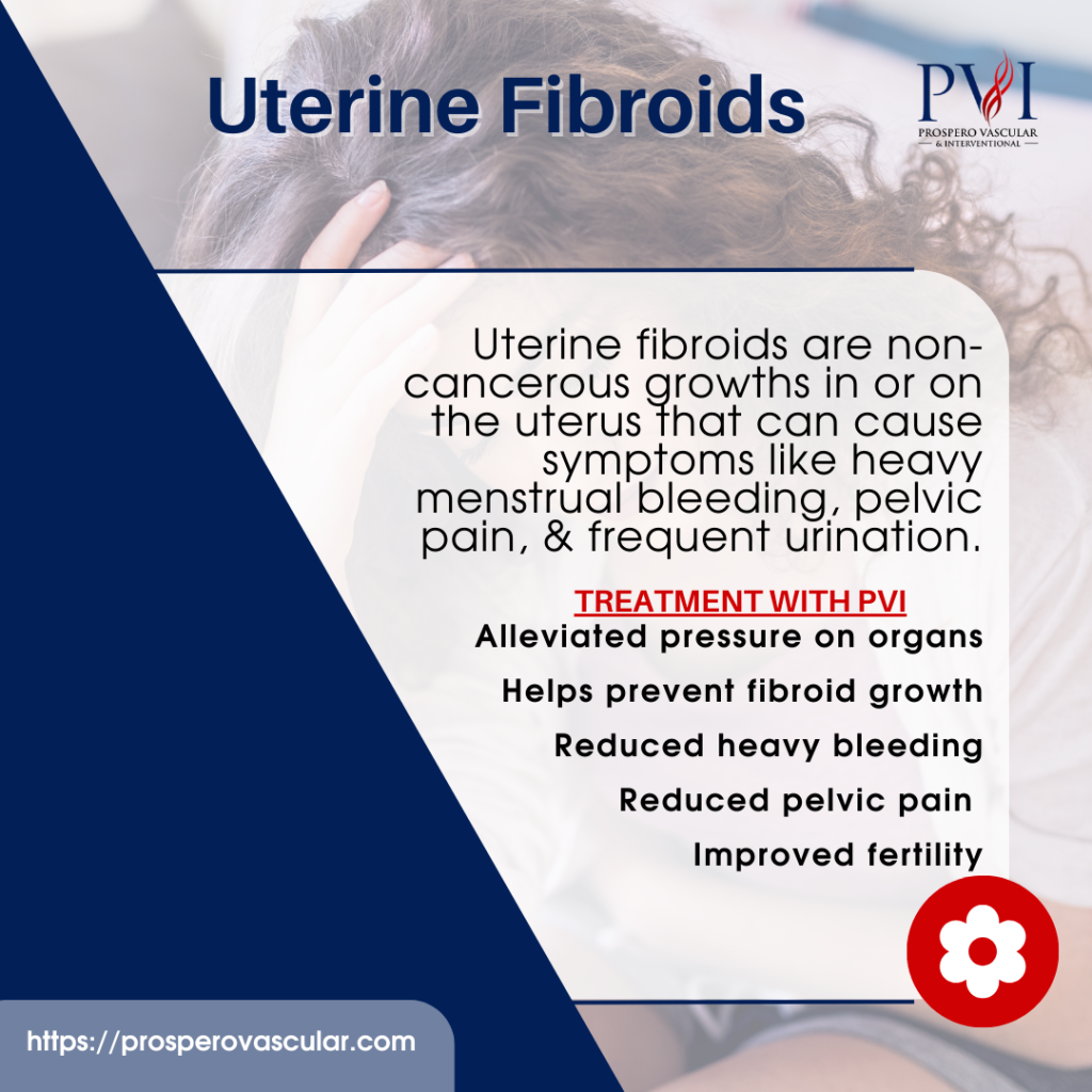 Uterine Fibroids