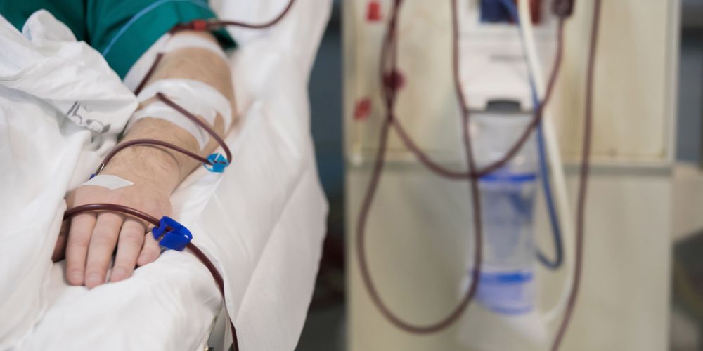 Dialysis-access-patient