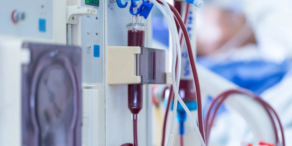 dialysis-access-procedure