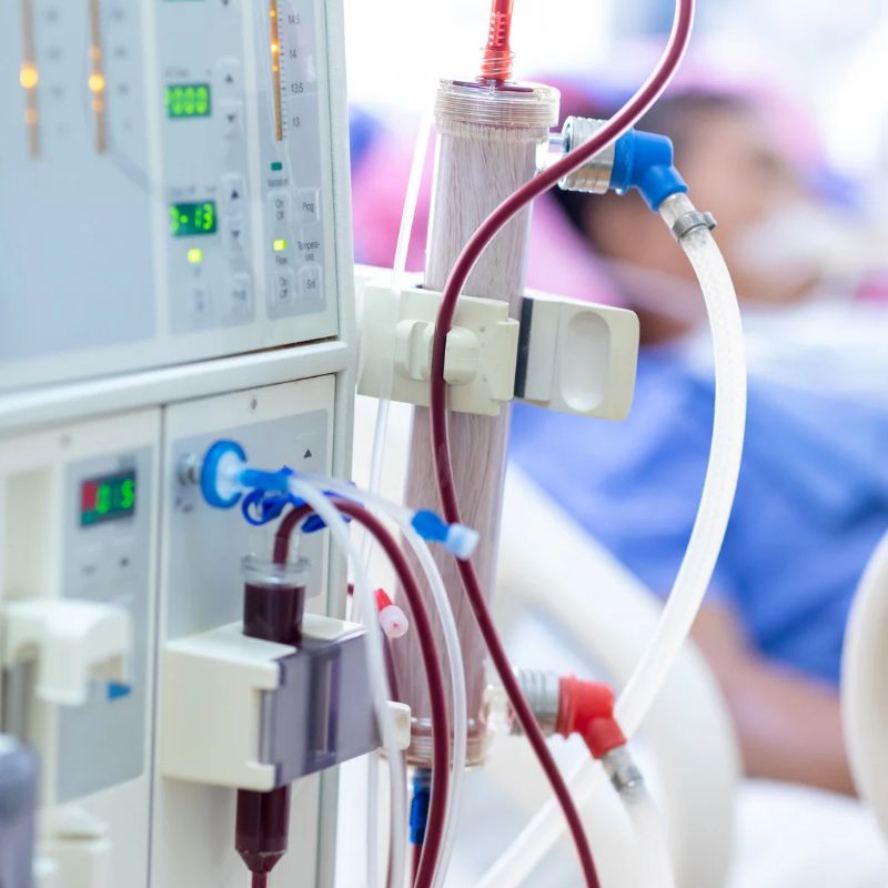 dialysis-access-service-dialysis-access-procedure